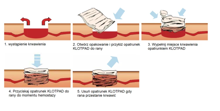 KLOTPAD.png
